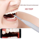 720P Stomatoscope  With 6 LED Light At head & 80 Degree  LargeVisualAngle Suitable ForKids, Pets & Adults IP67 Waterproof